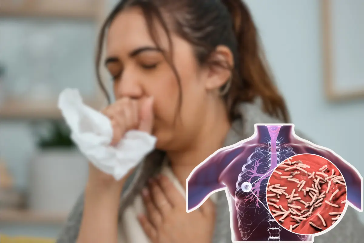 La tuberculosis (TB), una enfermedad infecciosa prevenible y curable, continúa siendo un problema de salud pública en Tamaulipas. Foto: CANVA