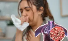 Tuberculosis en Tamaulipas: ¿cuántos casos hay confirmados?