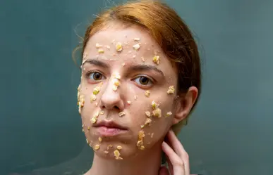 Con esta mascarilla limpia, refresca y dile adiós a la grasa del rostro