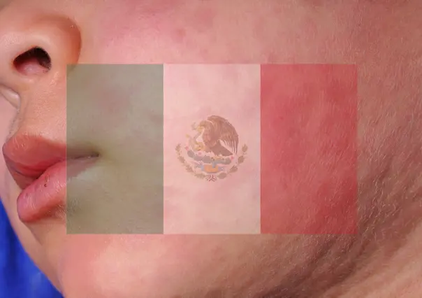 Sarampión en México: estos son los 7 estados que registran más casos