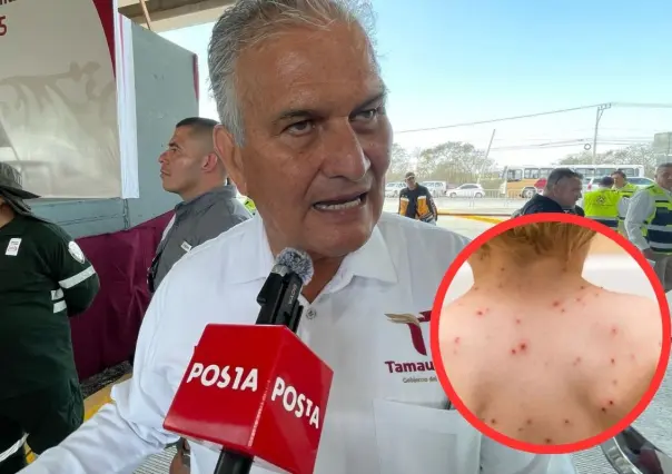 Tamaulipas presenta casos de sarampión traídos de Chihuahua en comunidad Menonita