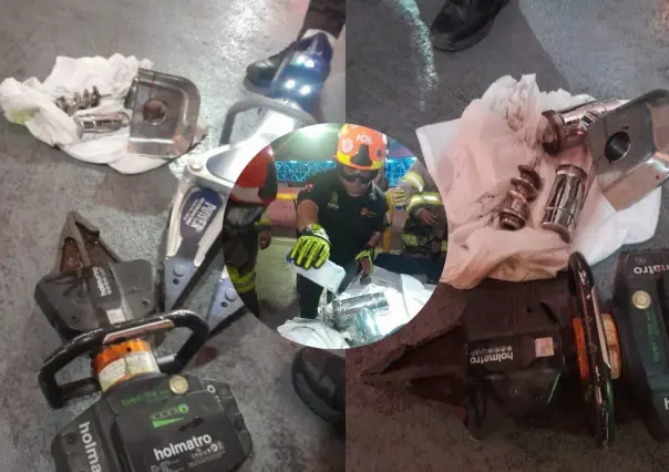 Menor pierde mano y parte de antebrazo tras accidente con molino de carne en Galeana