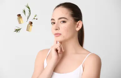 ¡Bueno, bonito y barato! Este remedio casero eliminará el acné y los puntos negros de tu rostro