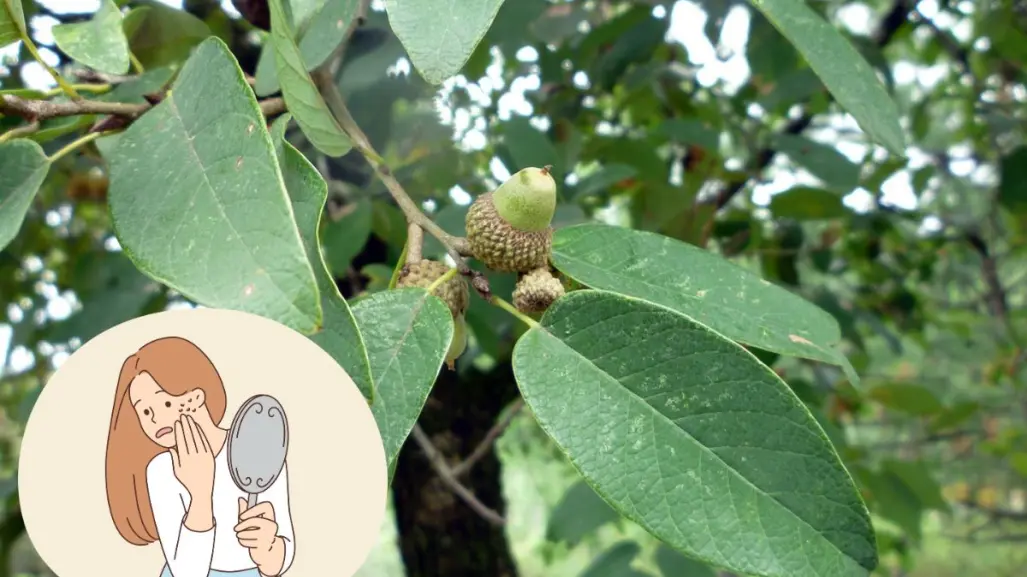 Este es el árbol nativo de Nuevo León que puede curar tus cicatrices y quemaduras