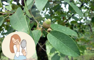 Este es el árbol nativo de Nuevo León que puede curar tus cicatrices y quemaduras