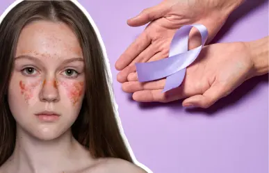 Llamado a la conciencia en Saltillo: Caminata Morada para visibilizar el lupus