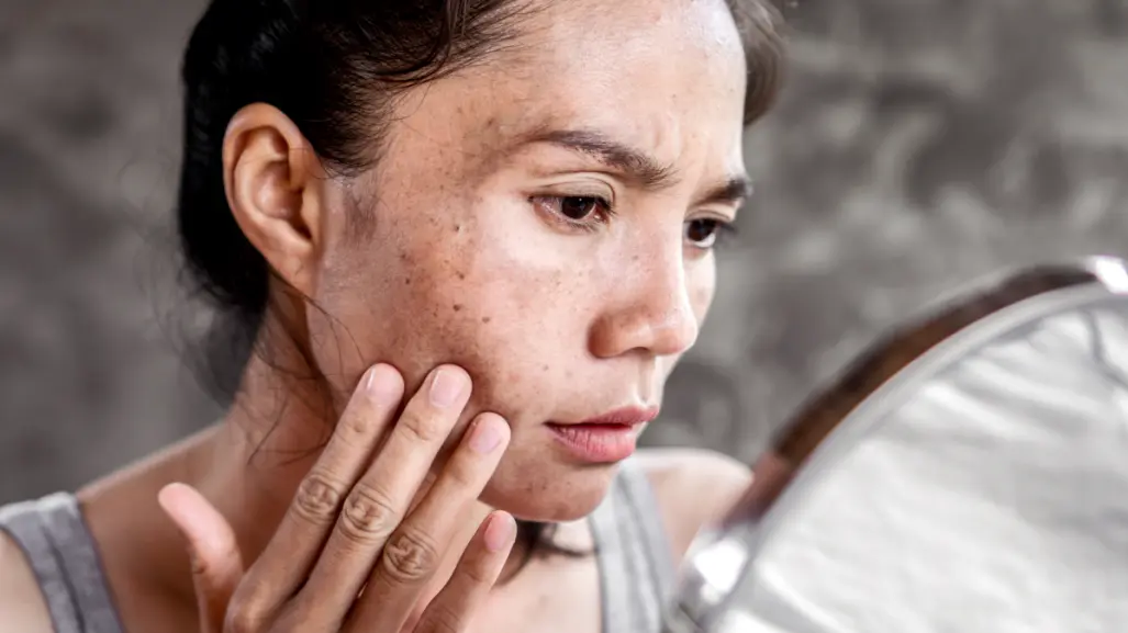 Dile adiós al paño de tu cara con esta mascarilla de 2 ingredientes
