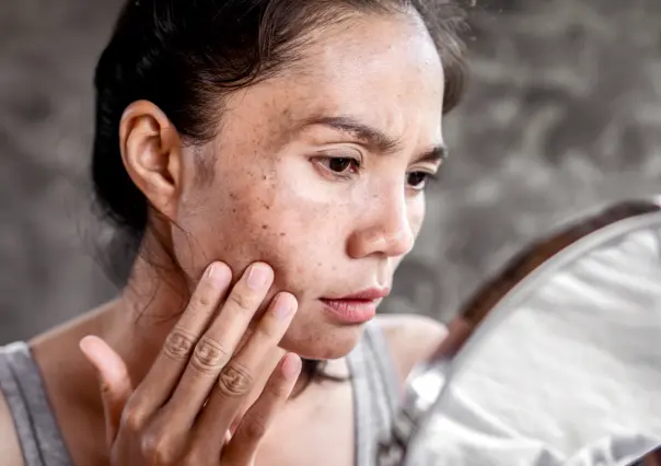 Dile adiós al paño de tu cara con esta mascarilla de 2 ingredientes