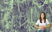 Conoce este árbol nativo de Nuevo León que puedes tratar en los problemas digestivos