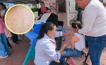¿Por qué resurgió el sarampión en Durango?