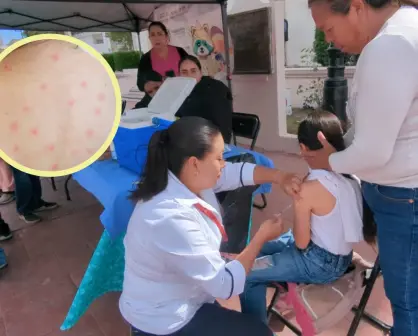 ¿Por qué resurgió el sarampión en Durango?