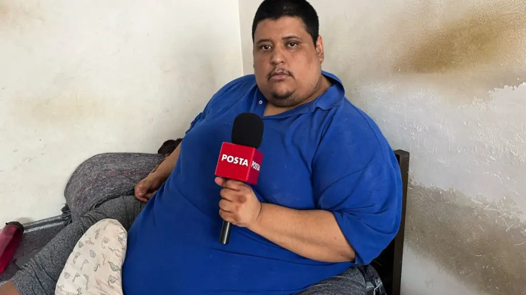 Hombre de más de 200 kilos emprende negocio para cubrir gastos de cirugía bariátrica