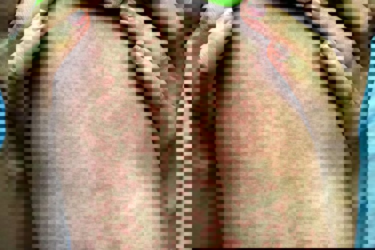 imagen-cuerpo imagen-cuerpo