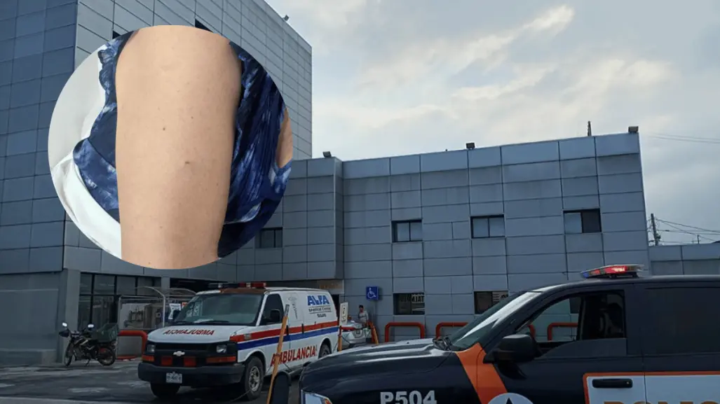 Alerta en Guadalupe: mujer recibe pinchazo mientras hacía fila en un banco