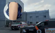 Alerta en Guadalupe: mujer recibe pinchazo mientras hacía fila en un banco