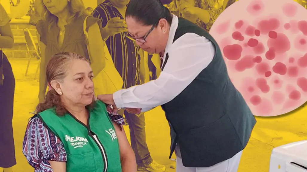 Coahuila detecta 8 casos activos de sarampión en el estado, refuerzan medidas preventivas
