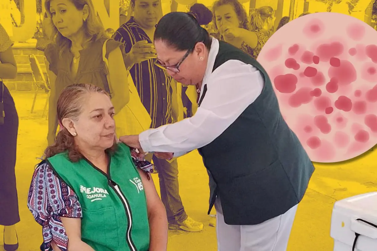 Secretaría de Salud refuerza prevención de Sarampión en Coahuila / Fotos: Gobierno de Coahuila | Canva
