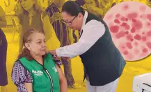 Coahuila detecta 8 casos activos de sarampión en el estado, refuerzan medidas preventivas