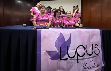 El lupus inspira puesta en escena para crear conciencia en Yucatán
