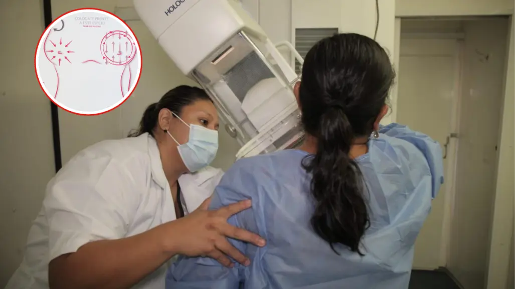 Mastografías gratuitas en Tamaulipas han ayudado a detectar más de 50 casos de cáncer