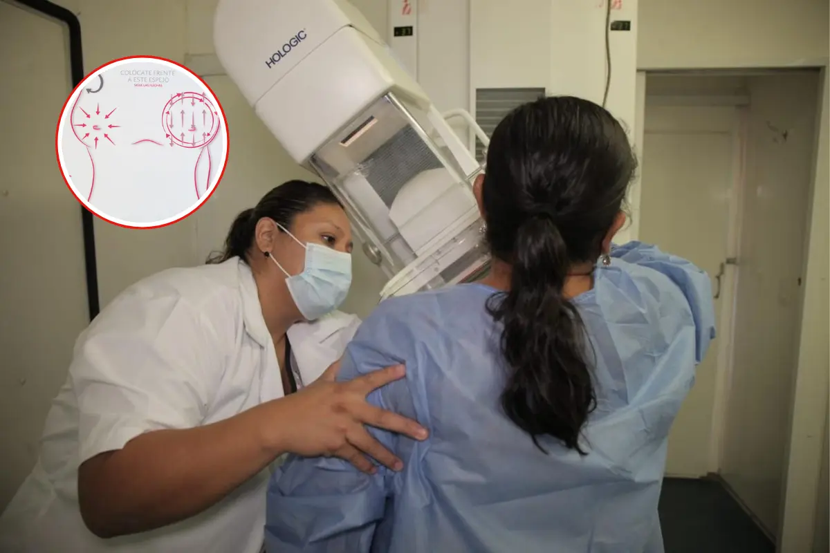 Acude a realizarte la mastografía completamente gratis | Foto: Victoria Jiménez