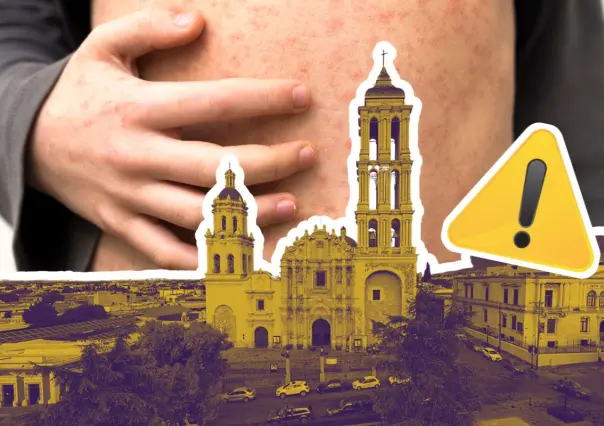 Coahuila en alerta: confirman primer caso de Sarampión en Saltillo 