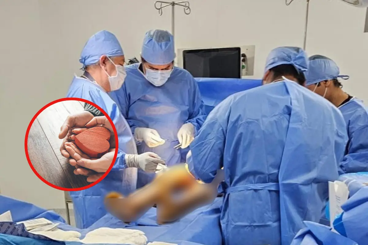 La procuración fue todo un éxito, beneficiando a 2 vidas | Foto: Perla Herrera