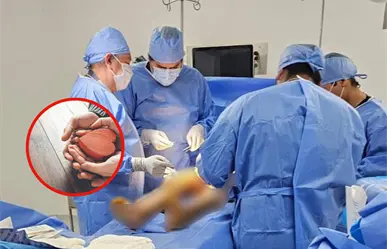 IMSS Tamaulipas realiza procuración de córneas y tejido músculo esquelético