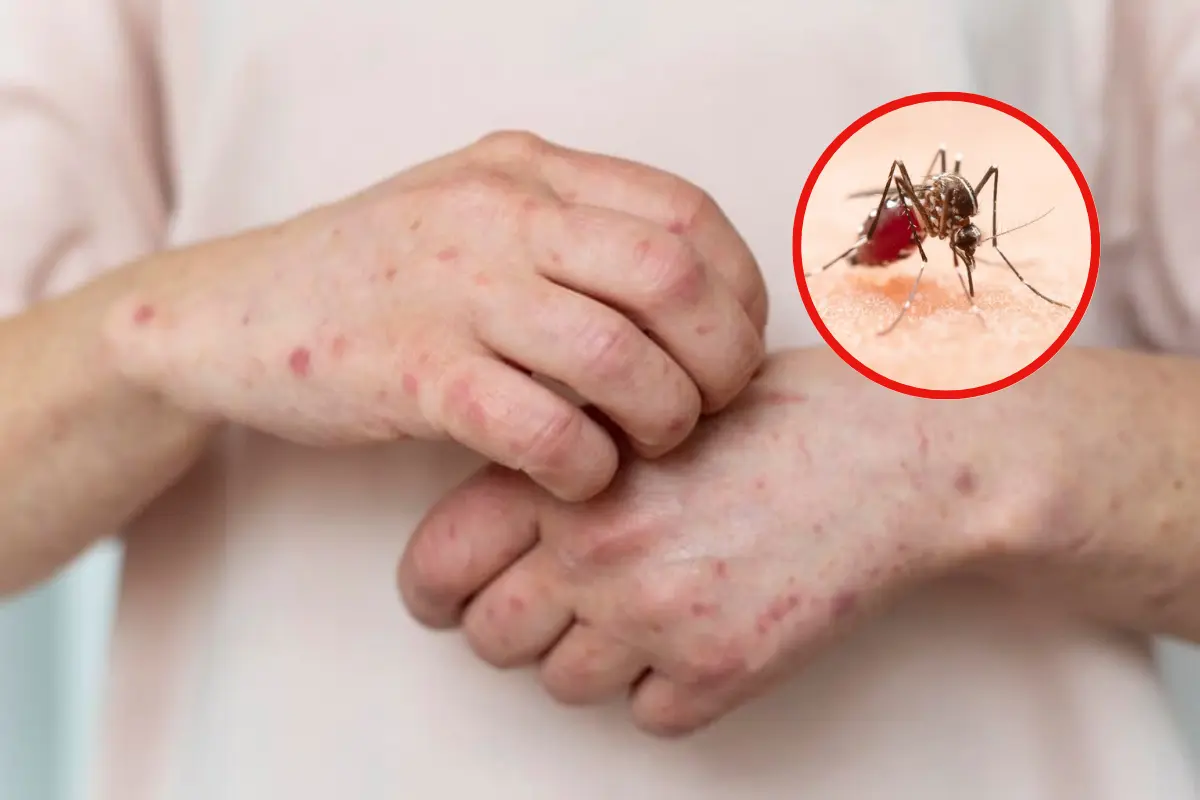 Realizan quinta reunión ordinaria para prevenir casos de dengue, sarampión y golpe de calor en Tamaulipas | Foto: Daniel Espinoza