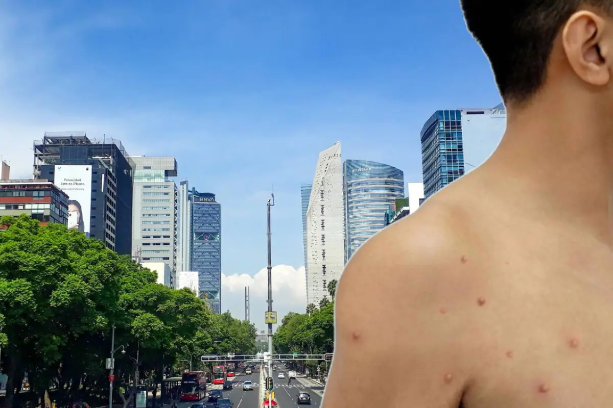 Paseo de la Reforma en CDMX con un chico contagiado de Viruela del mono. Foto: Google Maps ( Yrianí G) | X (@kyutipoz) | Canva