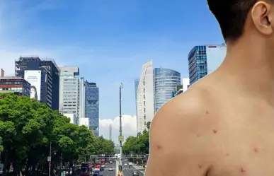 Viruela del mono se expande en CDMX: casos aumentan 20 veces en lo que del 2025