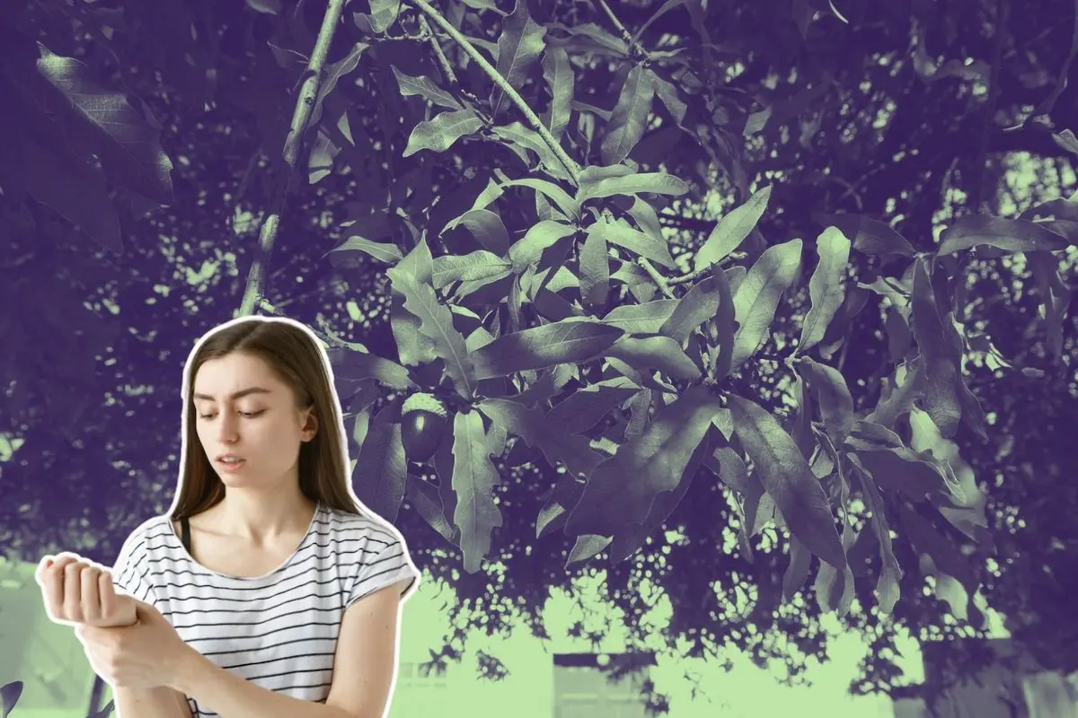 Este árbol nativo de Nuevo León posee propiedades medicinales útiles para tratar afecciones en la piel de forma natural. Foto: UANL / Freepik