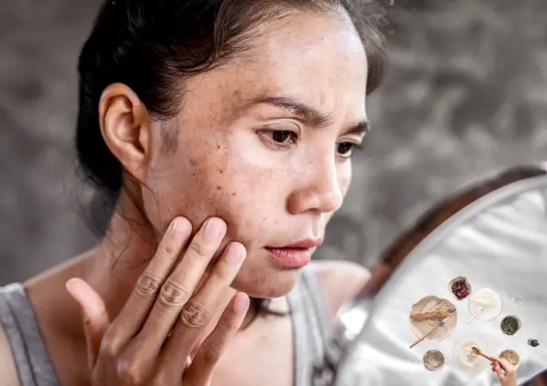 Guía práctica para desaparecer manchas por el sol con este remedio natural