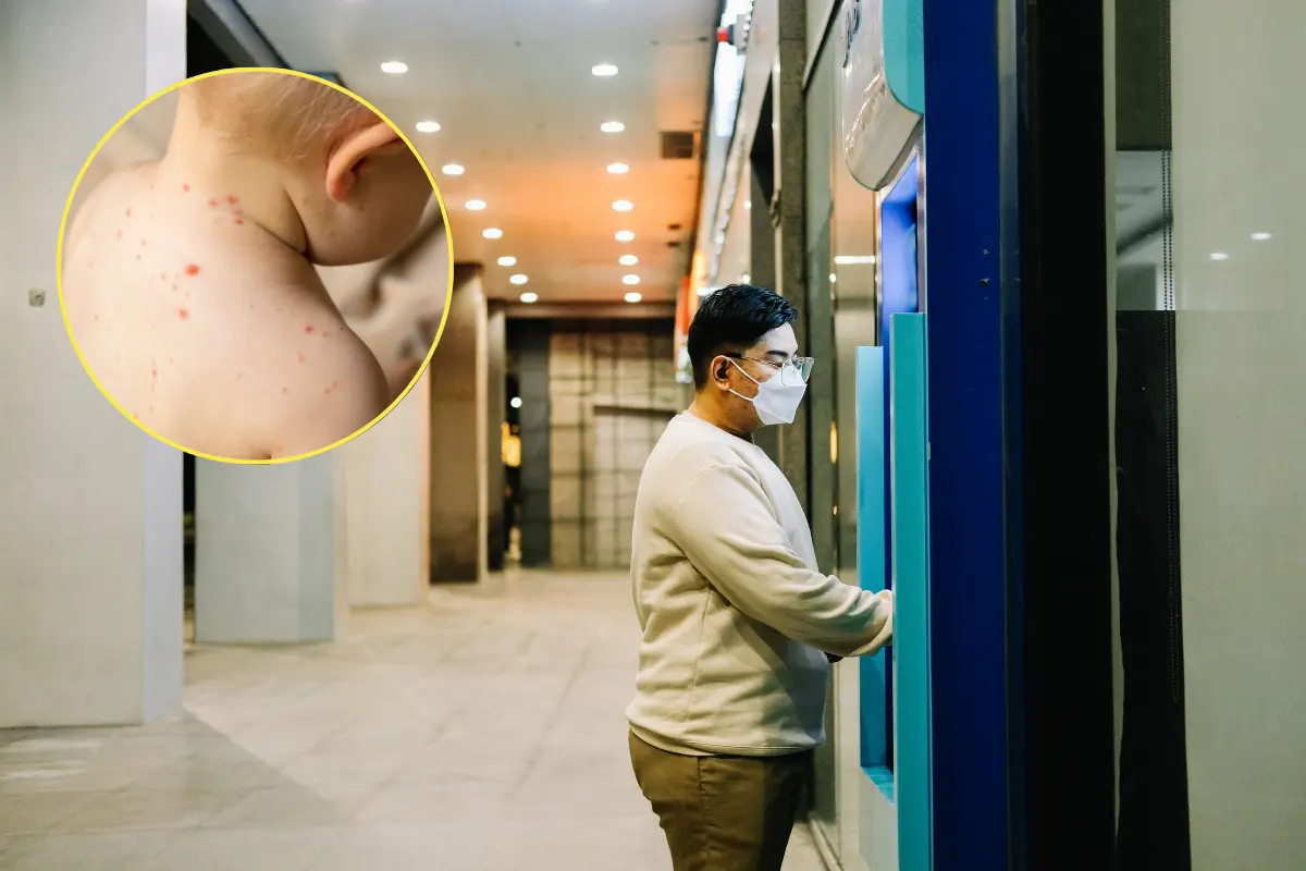 El sarampión es una enfermedad viral altamente contagiosa que puede afectar a personas de todas las edades./Foto: Canva