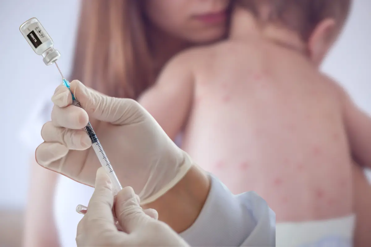 La Secretaría de Salud anuncia acciones para mantener a salvo a los infectados de sarampión, y además, prevenir contagios. Fotos Ilustrativas: Canva.
