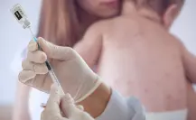 Tras confirmarse 3 casos de sarampión en Comondú, Salud BCS reforzará vacunación