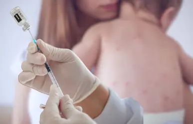 Tras confirmarse 3 casos de sarampión en Comondú, Salud BCS reforzará vacunación