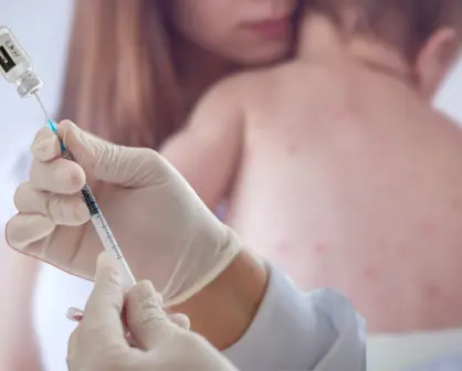 Tras confirmarse 3 casos de sarampión en Comondú, Salud BCS reforzará vacunación