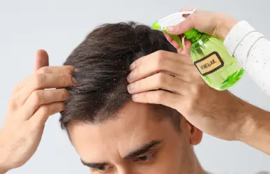 El Vinagre blanco es un remedio natural y económico contra la caspa