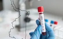 Aumentan los casos de VIH en Tamaulipas en junio