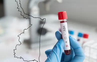 Aumentan los casos de VIH en Tamaulipas en junio