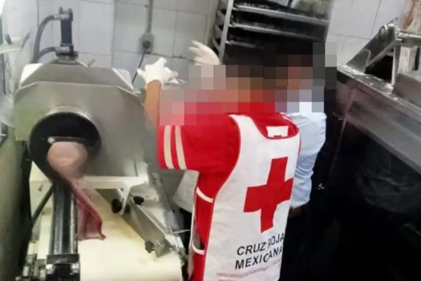 Minutos que se convirtieron horas, así lo vivió otra mujer al sufrir un accidente con un molino | Foto: Enrique Sierra, director de Voluntarios Zona Sur