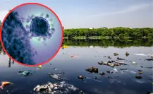 Enfermedades tras las lluvias: los riesgos de vivir entre aguas negras en el Edomex