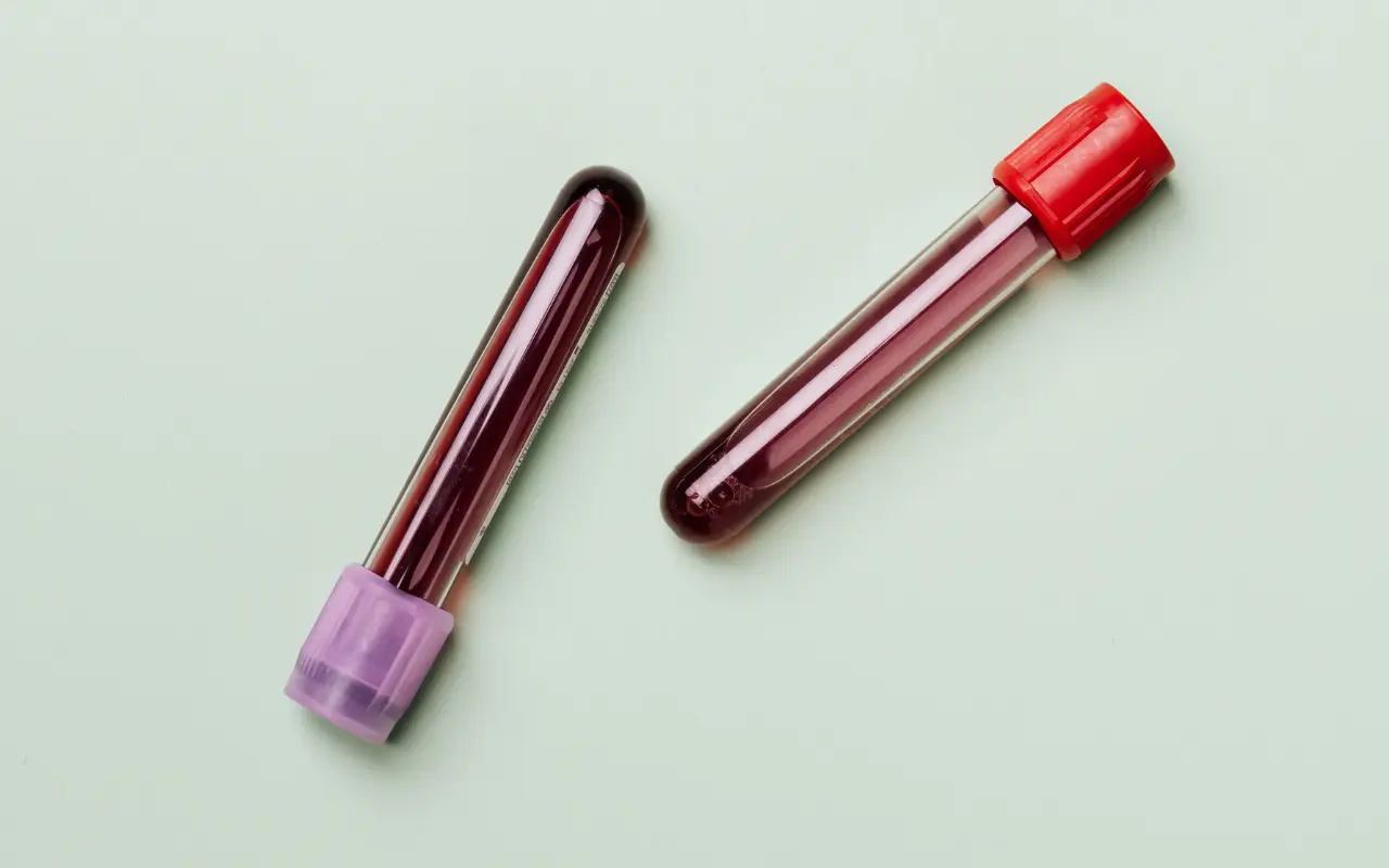 Muestras de sangre. Foto: Canva