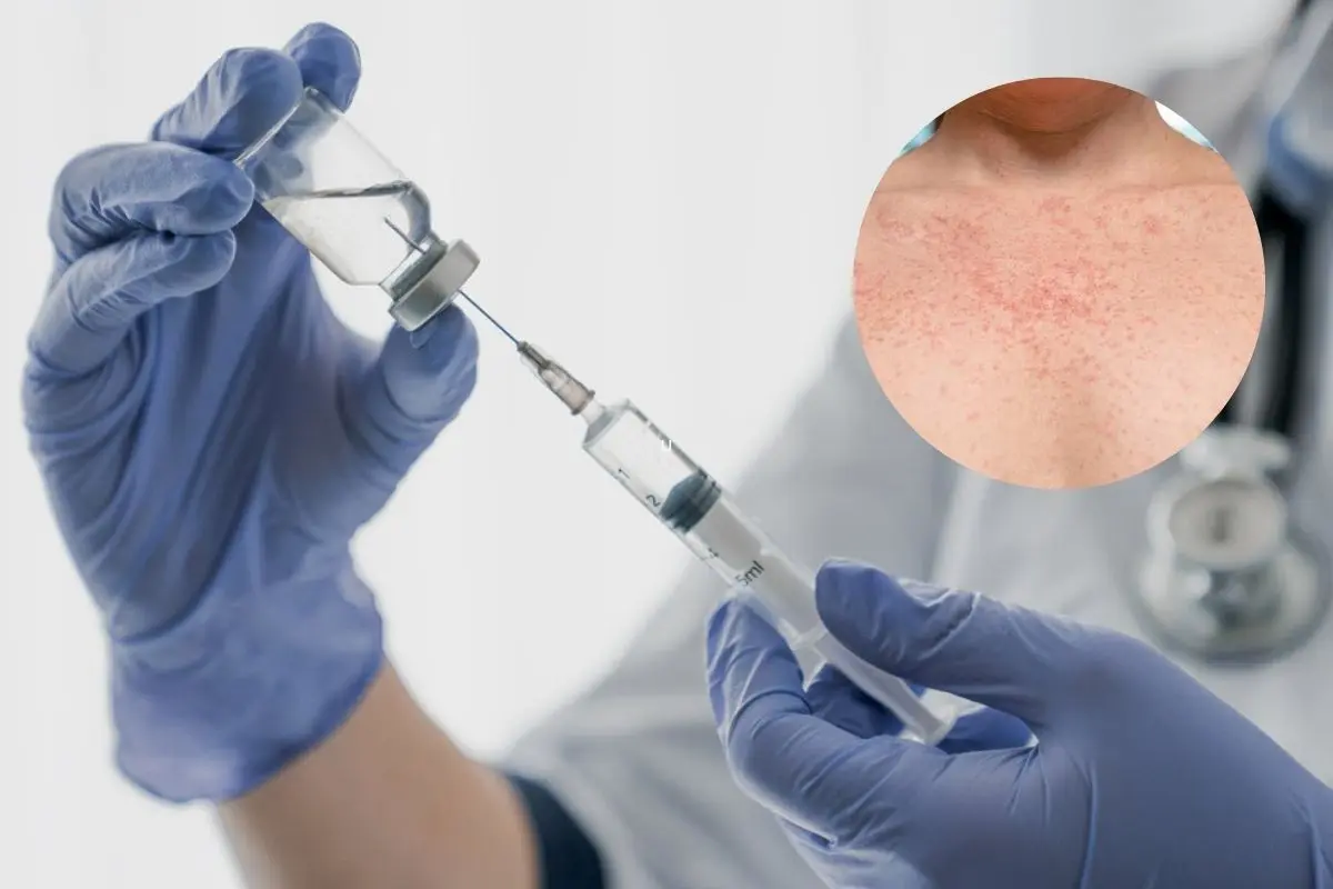 La Secretaría de Salud de Nuevo León hizo un llamado a la ciudadanía a vacunarse contra el sarampión al registrarse un caso importado del virus. Foto: Tec de Monterrey / CDC / Canva