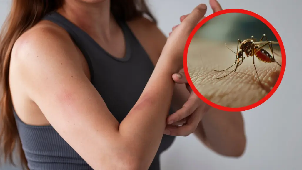 Descubre los mejores remedios caseros para ahuyentar mosquitos en Tamaulipas