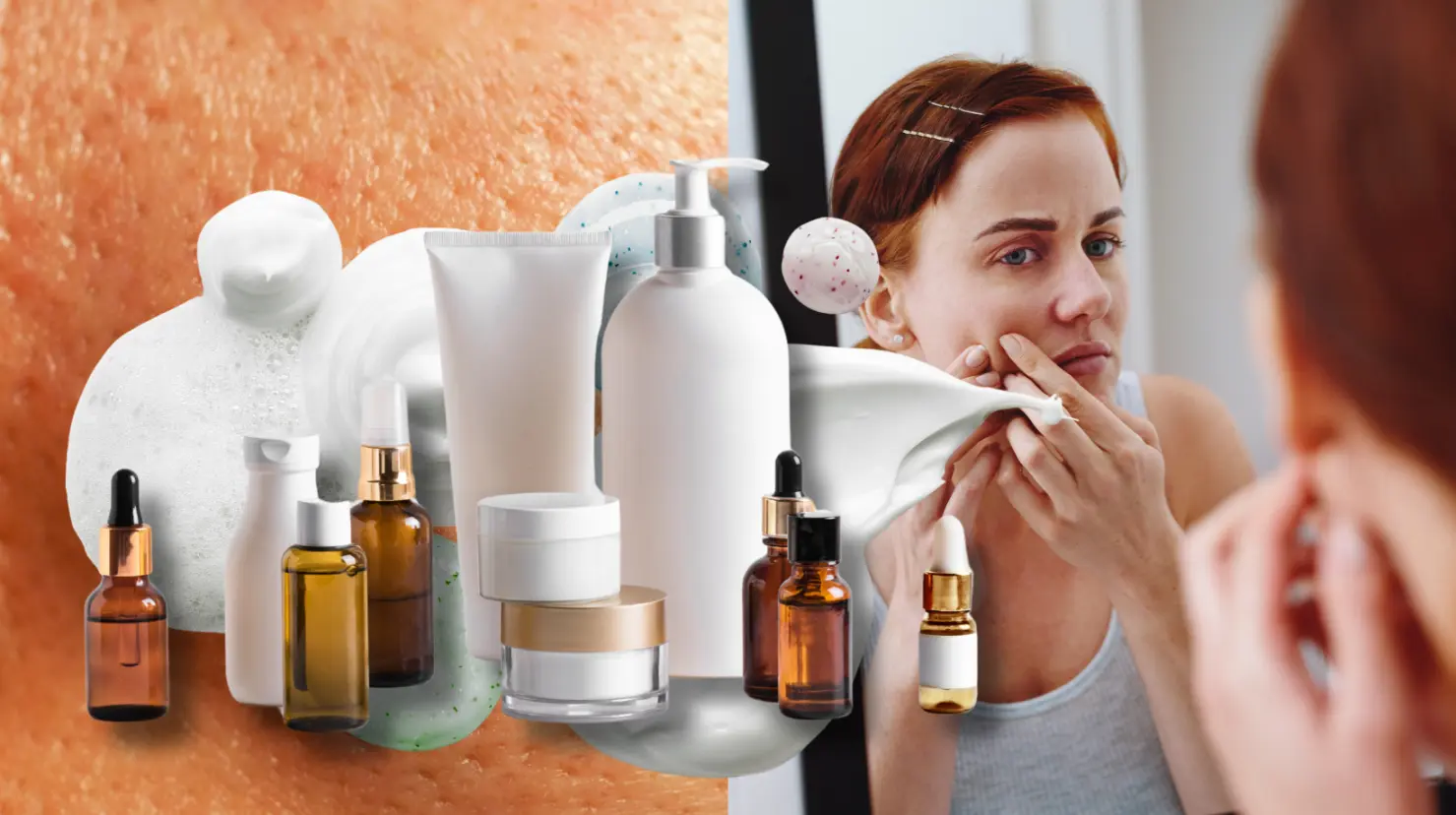 5 productos para eliminar puntos negros sin dañar la piel. Foto: Canva.