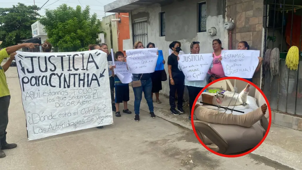 Cynthia puede perder sus dos piernas y su victimario escapó de la responsabilidad