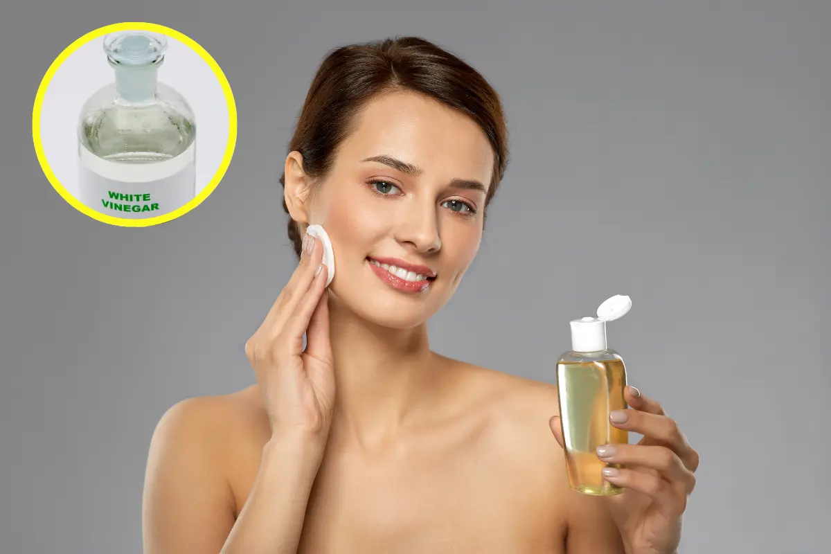 El uso del vinagre blanco para eliminar la grasa facial es poco conocido, pero muy efectivo. Foto: Canva