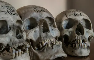 Investigan hallazgo de restos humanos en la carretera Telchac Puerto–Progreso